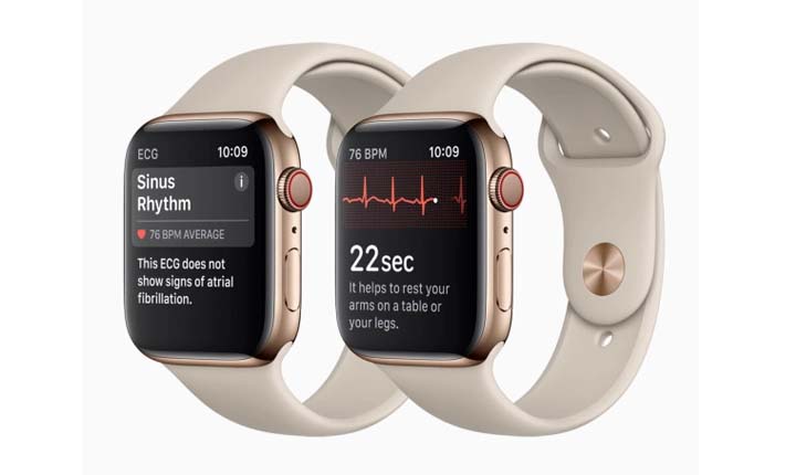 Kelebihan Apple Watch