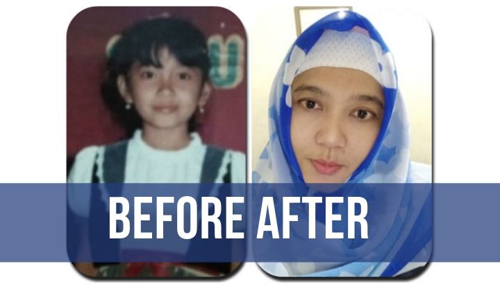 before after photo