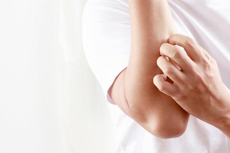 cara menghilangkan gatal di badan